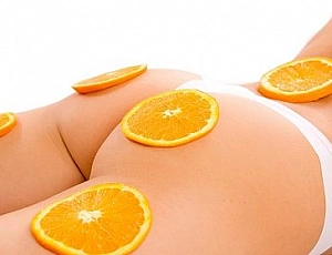 Die 20 besten Anti-Cellulite-Cremes