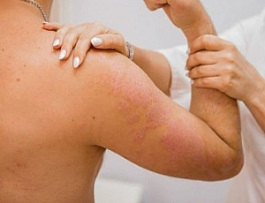 Top 10 Psoriasis-Behandlungskliniken in Moskau