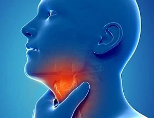 16 beste Heilmittel für Tonsillitis