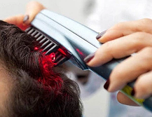 Die 5 besten Laserkämme gegen Haarausfall